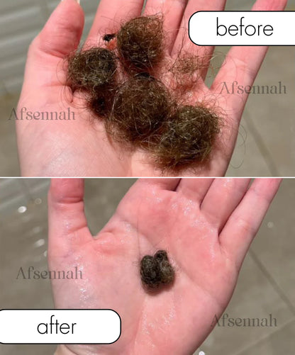 🌸Custom Hair Growth OilORIGINAL-  ®