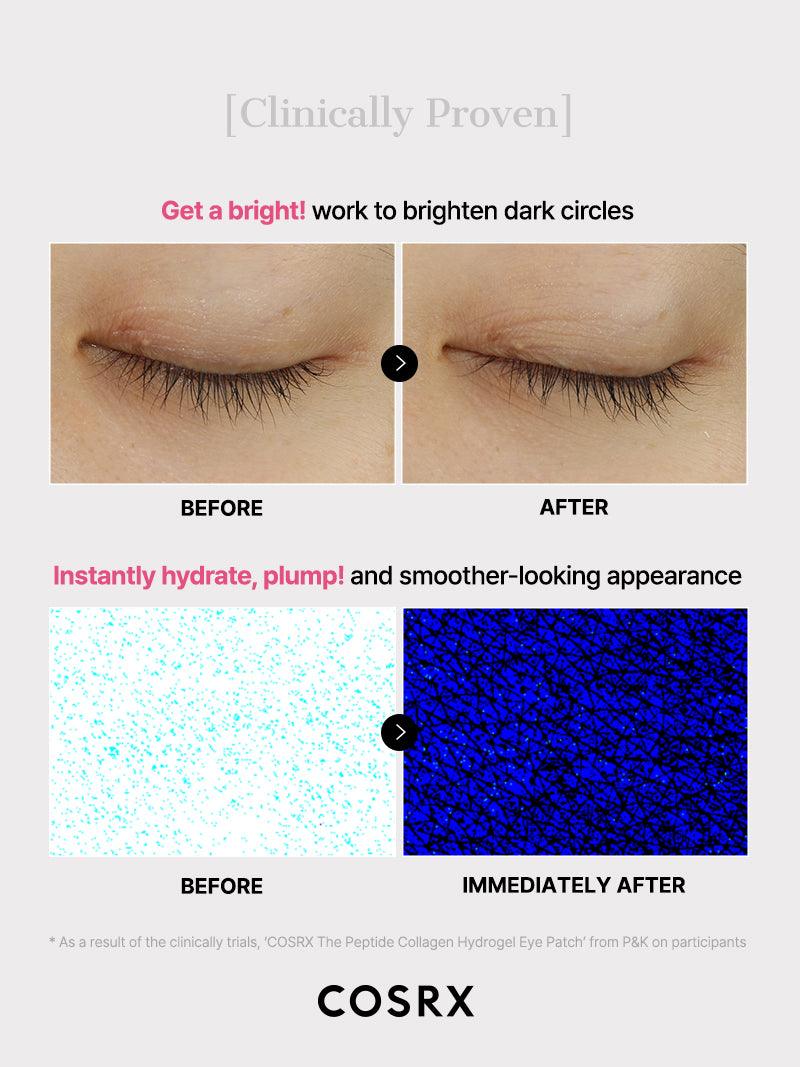 🌸The Cosrx Collagen Hydrogel Eye Patch ®