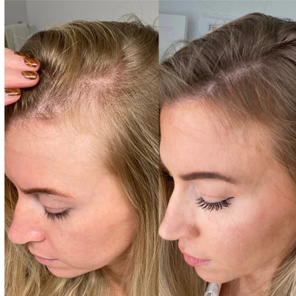 🌸Custom Hair Growth OilORIGINAL-  ®